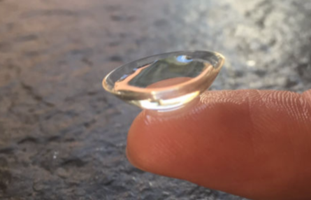 Sklerallinsen Speziallinsen Individuallinsen Keratokonus Keratoplastik "Kontaktlinsen Salzburg"